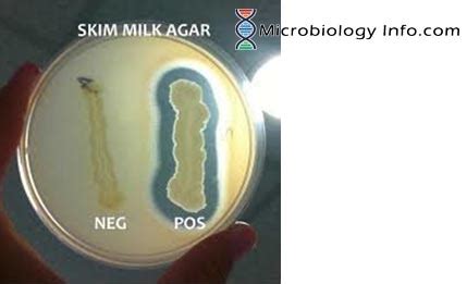 Casein Hydrolysis Test: Principle, Procedure, and Uses.